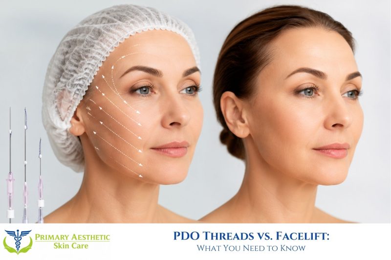 PDO Threads vs. Facelift: What You Need to Know